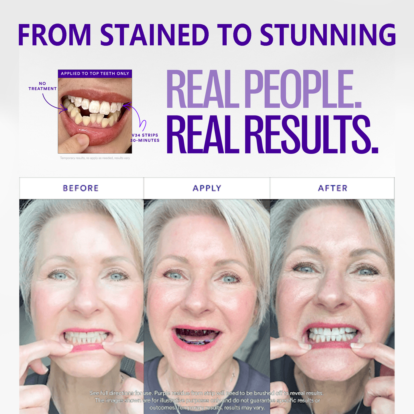 ✨Clinclii™ V36 Whitening Strips – Professional Teeth Whitening at Home(UPGRADED VERSION)