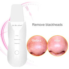 Ultrasonic Skin Scrubber Ultrasonic Facial Cleansing Face Skin Peeling