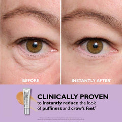 🔥Last Day 49% OFF🎁Temporary Eye Tightener