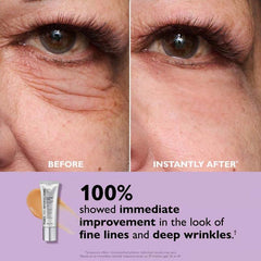 🔥Last Day 49% OFF🎁Temporary Eye Tightener